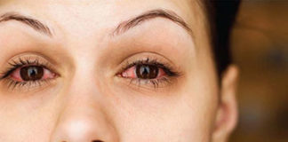 Pripremili pacijenticu za operaciju mrene, no dočekalo ih je iznenađenje pacijentica lece