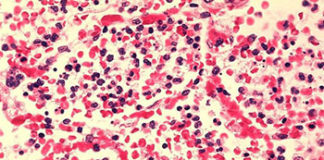 cjepivo lose bakterije