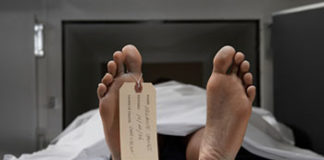 krvna pretraga alzhe