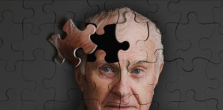 Stiže nam test za rano otkrivanje Alzheimera alch