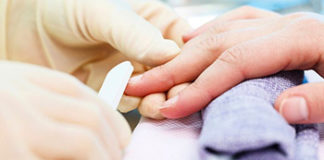 Ako primijetite ove promjene na noktima, odmah se javite liječniku nokti