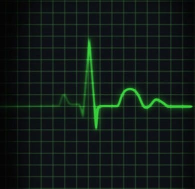 EKG