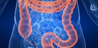 Koji su simptomi raka debelog crijeva crijevaheno