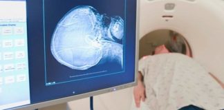 Moždani udar kicman