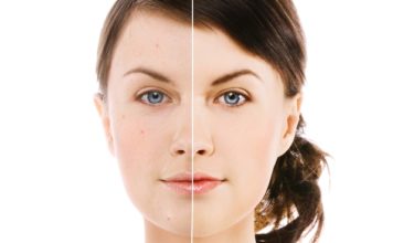 Stručnjaci preporučuju polali