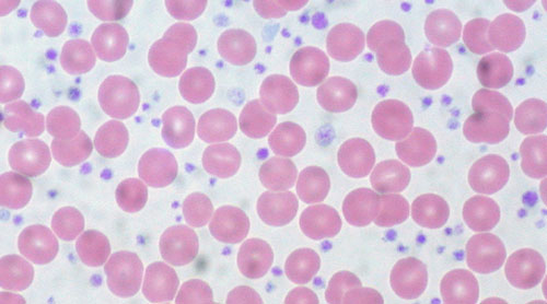 povecan broj trombocita