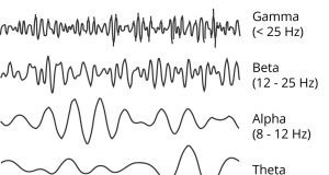 Opasne visoke frekvencije