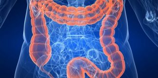 Znate li koji su simptomi raka debelog crijeva?